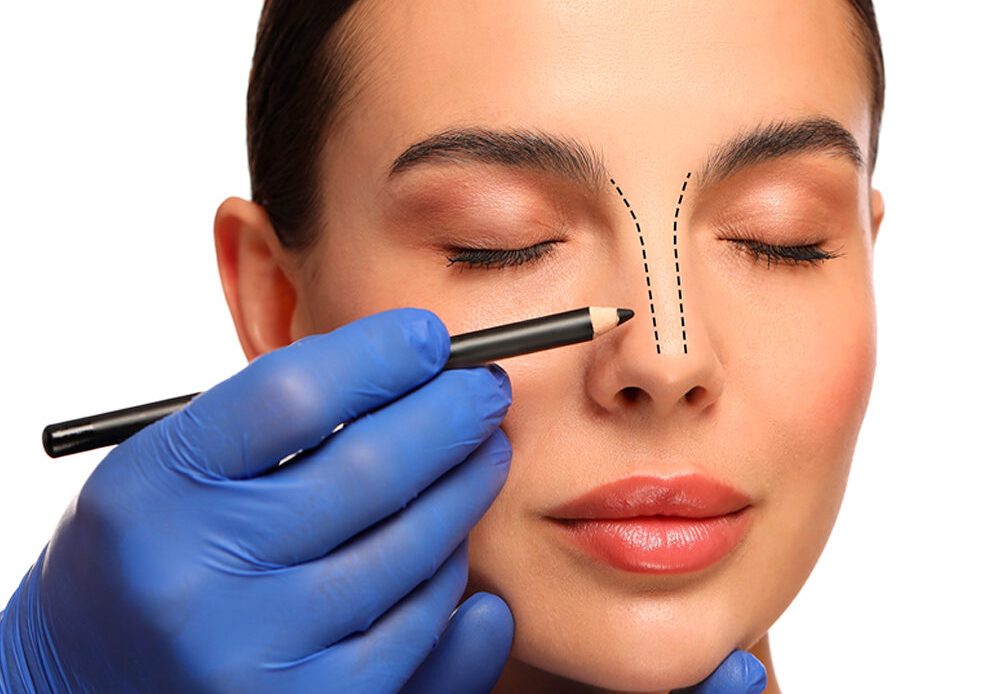 Rhinoplasty is a surgical procedure to reshape or resize the nose for aesthetic or functional improvement. It enhances facial harmony and can improve breathing.